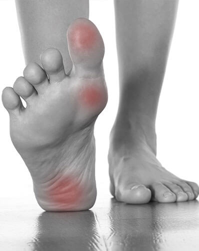 Physiotherapy and plantar fasciitis
