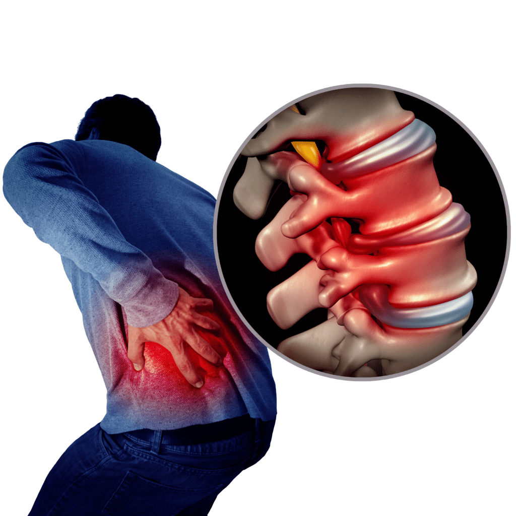 Bulging And Herniated Discs Explained Physical Health Care